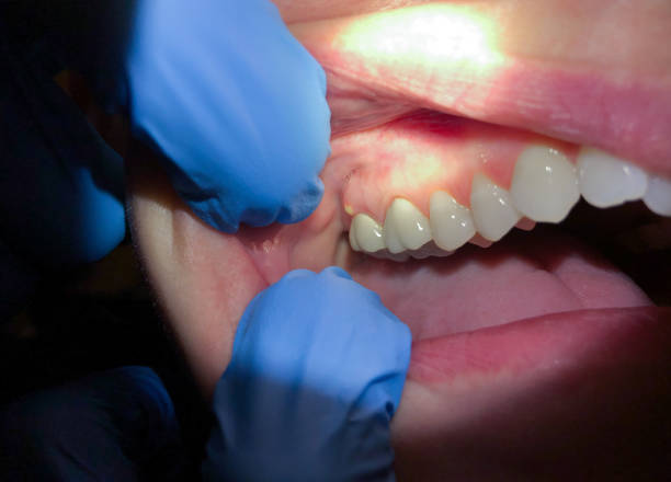 Best Emergency Treatment for Toothache in North Shore, VA